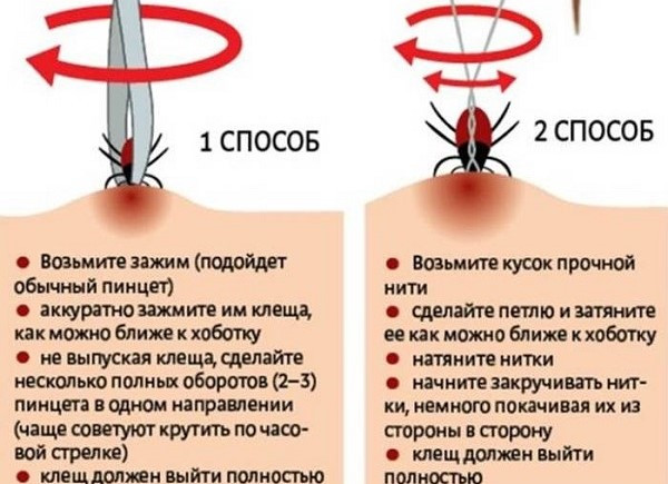 Как вытащить клеща с помощью пинцета и нитки