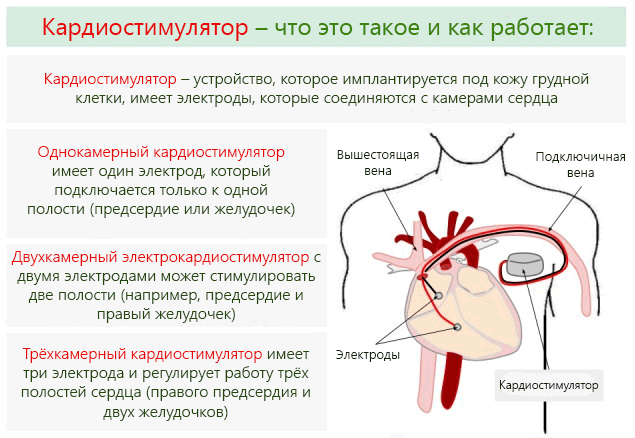 Спасение жизни - изображение №1